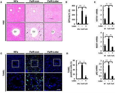 The Antidiabetic Drug Lobeglitazone Protects Mice From Lipogenesis-Induced Liver Injury via Mechanistic Target of Rapamycin Complex 1 Inhibition